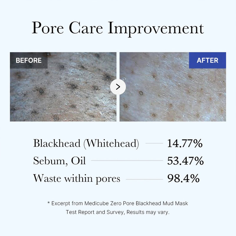 Deep Pore Cleansing for Visibly Blackhead-Free Skin