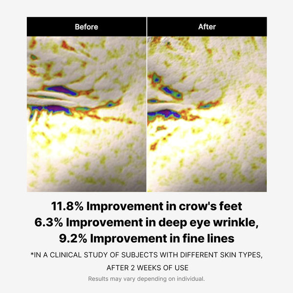 Puffiness Reduction
