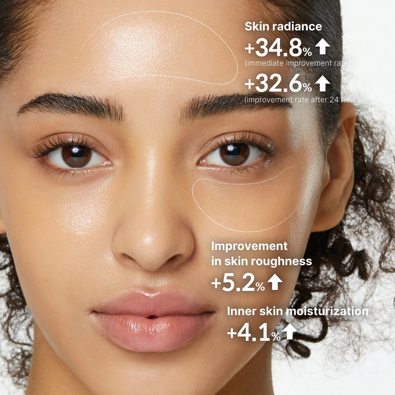 Visible Improvement in Post-Acne Marks