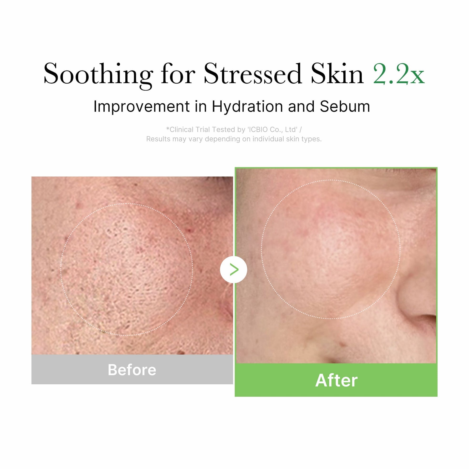 Exosome Cica Calming Full Set