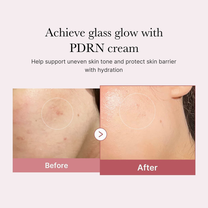 Hyaluronic Acid + Peptide Complex
