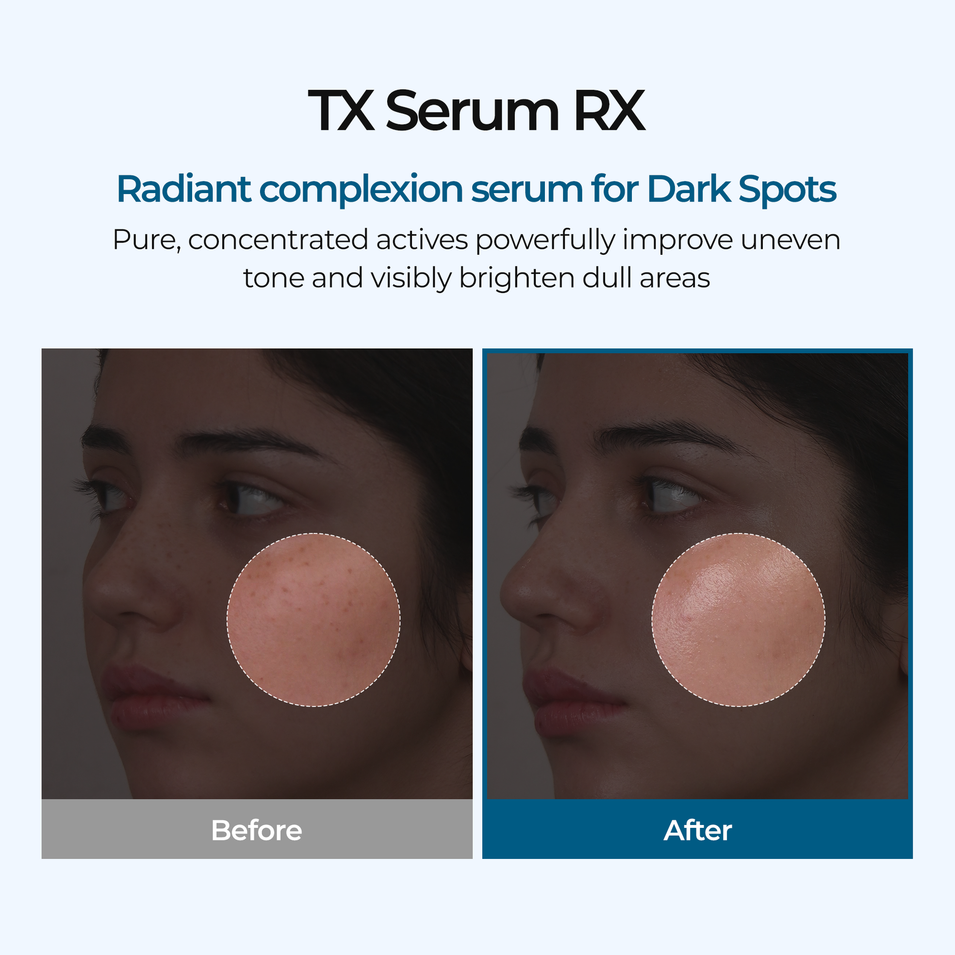 TX Ampoule Rx